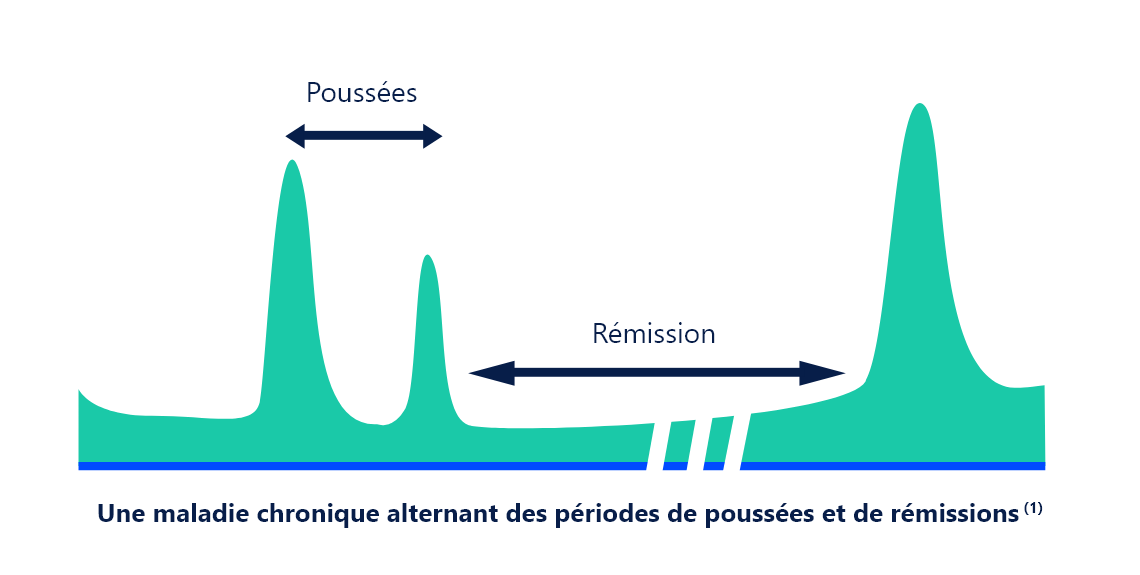 Une maladie chronique alternant des périodes de poussées et de rémissions